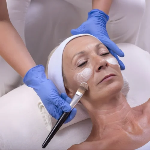 Acne Facial