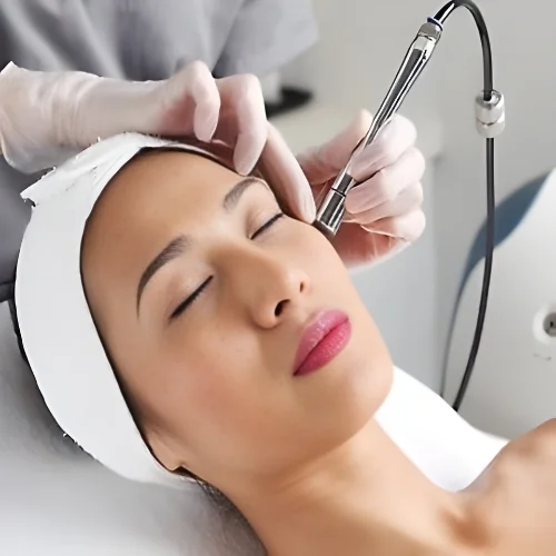 Microdermabrasion